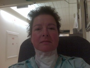 The morning after the 1st surgery. 10/2010. Hair got chopped because I didn't think I'd be able to wash it for quite a while.